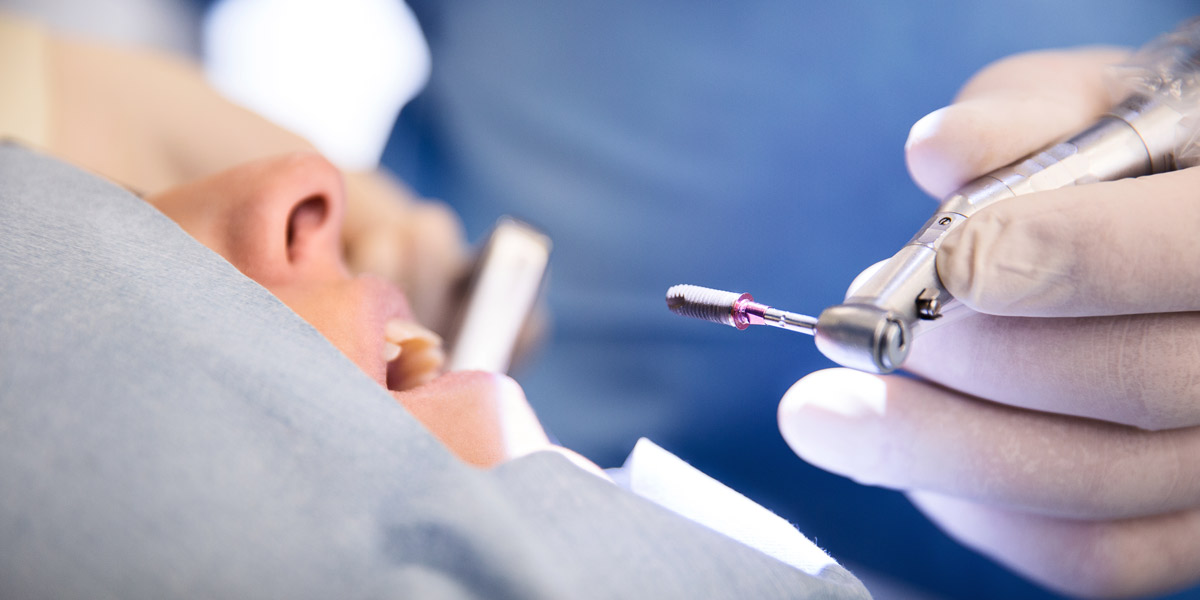 Zahnimplantate für Prothesenträger – Funktion und Ästhetik, die glücklich machen kann